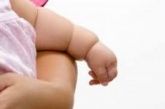 Curso Obesidade Infantil / 60 horas